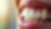 Close-up view of a healthy set of teeth and gums