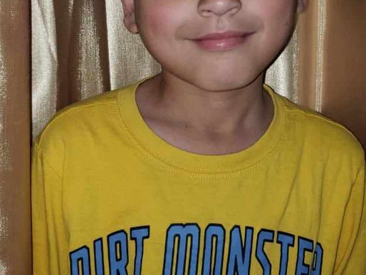 Facebook Memory – May 20, 2024
CF Vests Worldwide donated a Hill Rom Cystic Fibrosis vest to Haroun in #tunisia.