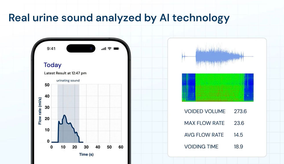 proudP real urine sound analyzed by AI technology