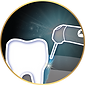 Periodontics LiteTouch laser לייטאץ לייז