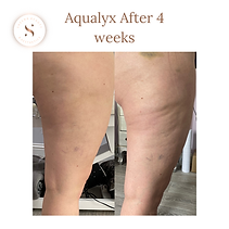 Aqualyx (9).png