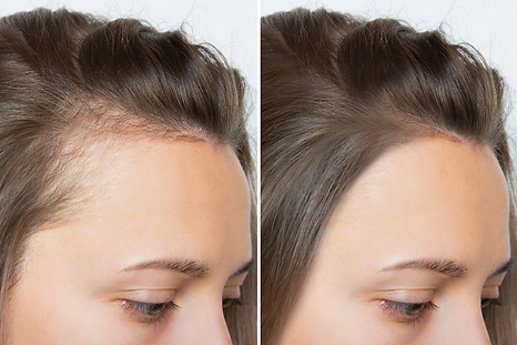 hair.webp
