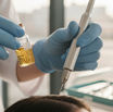 PRP vs GFC for Hair Loss: Which Regenerative Therapy is Right for You?