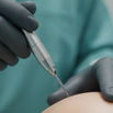 FUE vs DHI Hair Transplant: Choosing the Superior Path for Restoration in 2026
