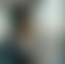 How Long Does a Hair Transplant Last? Longevity and Results in 2026