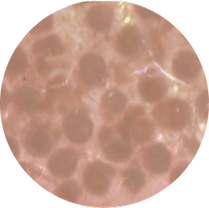 micrografts image.png