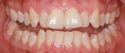 proven-results-per-d7x1.jpg