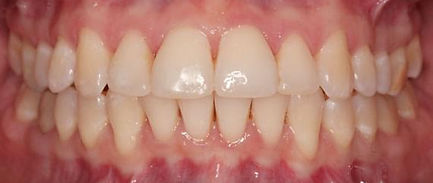 proven-results-per-d6x1.jpg