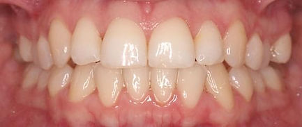 proven-results-per-d2x1.jpg