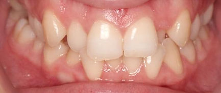proven-results-per-d1x1.jpg