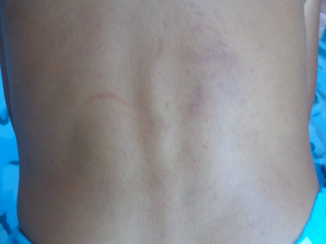 Capítulo 8 - Ameaças e agressões