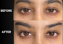 LINE_ALBUM_FOXY EYES_250822_5.jpg