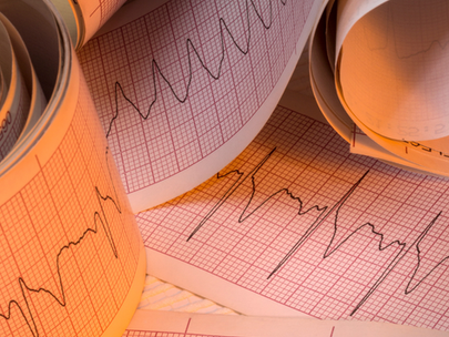 «Кольнуло сердце» – когда это тревожный сигнал и зачем обращаться к кардиологу?