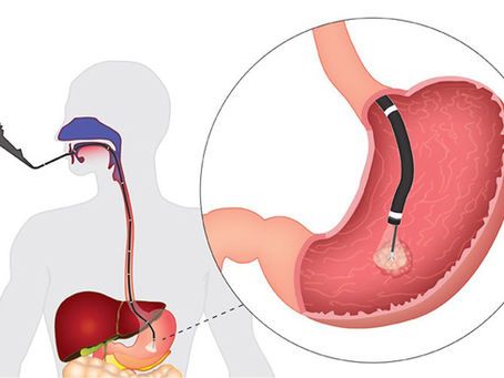 Боли ли гастроскопия?