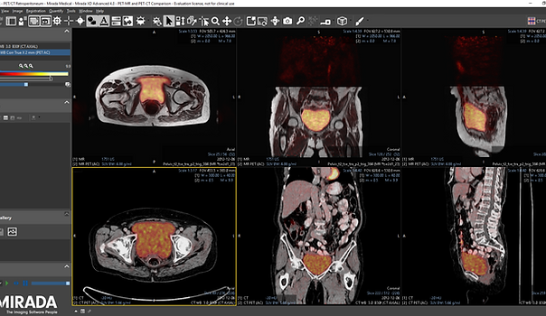 PETMR-PETCT-1-1536x830 (1).png
