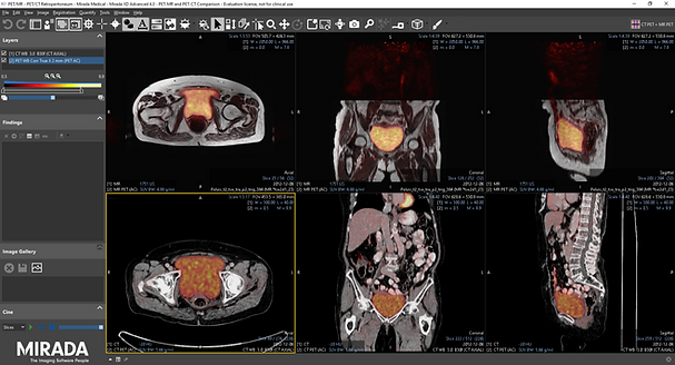 PETMR-PETCT-1-1536x830 (1).png