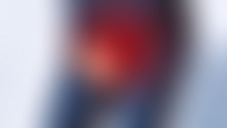Herecsavarodás – a hirtelen herefájdalom életet és herét veszélyeztethet