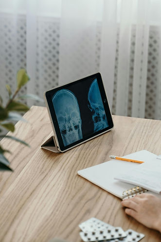 Review of Skull X-Rays
