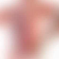 ANKYLOSING SPONDYLITIS (AS): MISSING LINK TO GET RELIEF