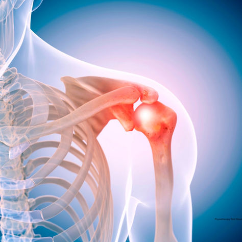 Physiotherapy Post Shoulder Surgeries: Don't push yourself too much!!