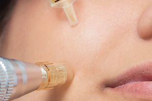 microneedling modesto