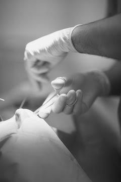 Soins Pré-op - Post-op