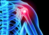Shoulder pain