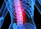 Back pain