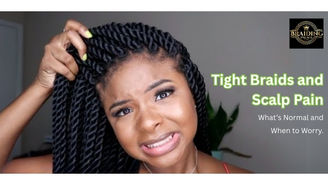 Tight Braids and Scalp Pain