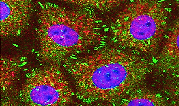 Confocal-fluorescent-micrographs-showing-localization-of-focal-adhesion-kinase-green.png