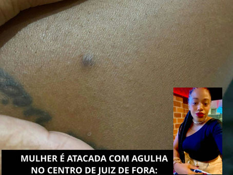 MULHER É ATACADA COM AGULHA NO CENTRO DE JUIZ DE FORA: 'VI QUE MINHA PERNA TAVA SANGRANDO'