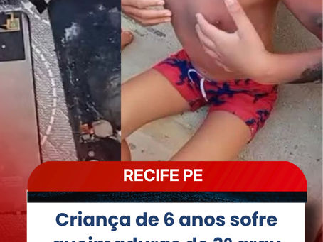 Criança de 6 anos sofre queimaduras de 3° grau após explosão de celular em Recife