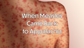 A wide-format preview image featuring a blurred, close-up photograph of a skin rash with numerous red, blotchy spots. Overlaying the center is the white, bold text: "When Measles Came Back to Appalachia."