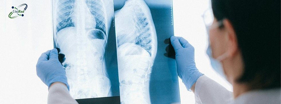 RAYOS X DE Tórax EN UNIRAD UNIDAD DE RADIOLOGIA SUCURSALES ALTABRISA Y CAUCEL MÉRIDA, YUC