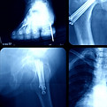 RAYOS X DE EXTREMIDADES MANOS PIES CLAVICULA HOMBRO MULECA EN UNIRAD UNIDAD DE RADIOLOGIA
