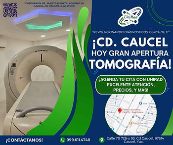 ¿Qué es una tomografía computada y para qué sirve?