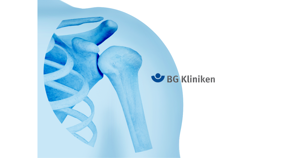 Specialist L5: Schulter - Proximale Humerusfrakturen "BG & Guests"