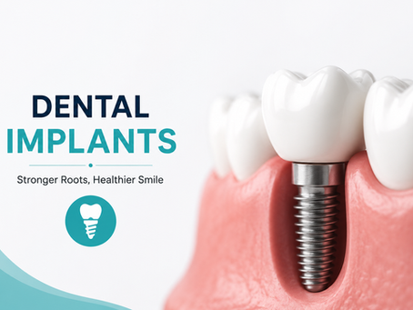 Missing Teeth? Try Dental Implants Treatment in Ahmedabad