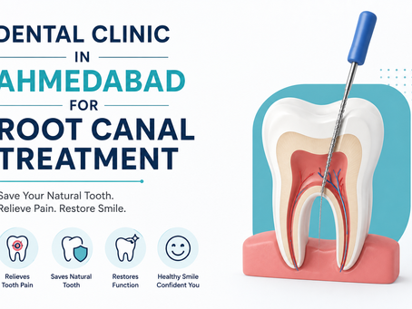 Dental Clinic in Ahmedabad for Root Canal Treatment