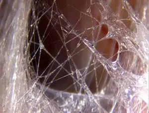 Close-up image of fascia tissue in a living body, showing its intricate web-like structure.
