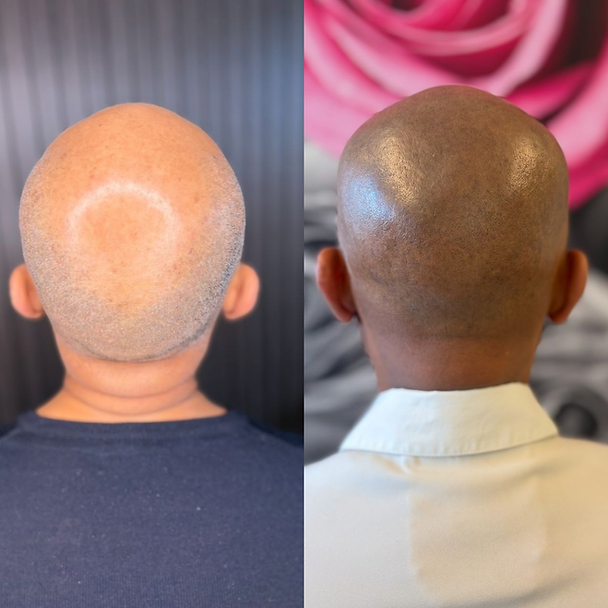 Beige White Minimalist Beauty Skincare Before After Collage Instagram Post.PNG