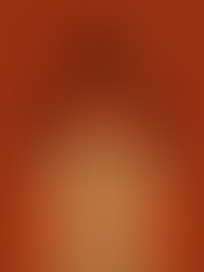 An angry person with a lit fuse on their head stands against a red background, wearing a beige shirt.