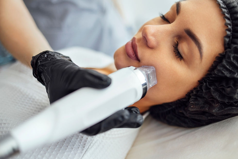 PRP Microneedling