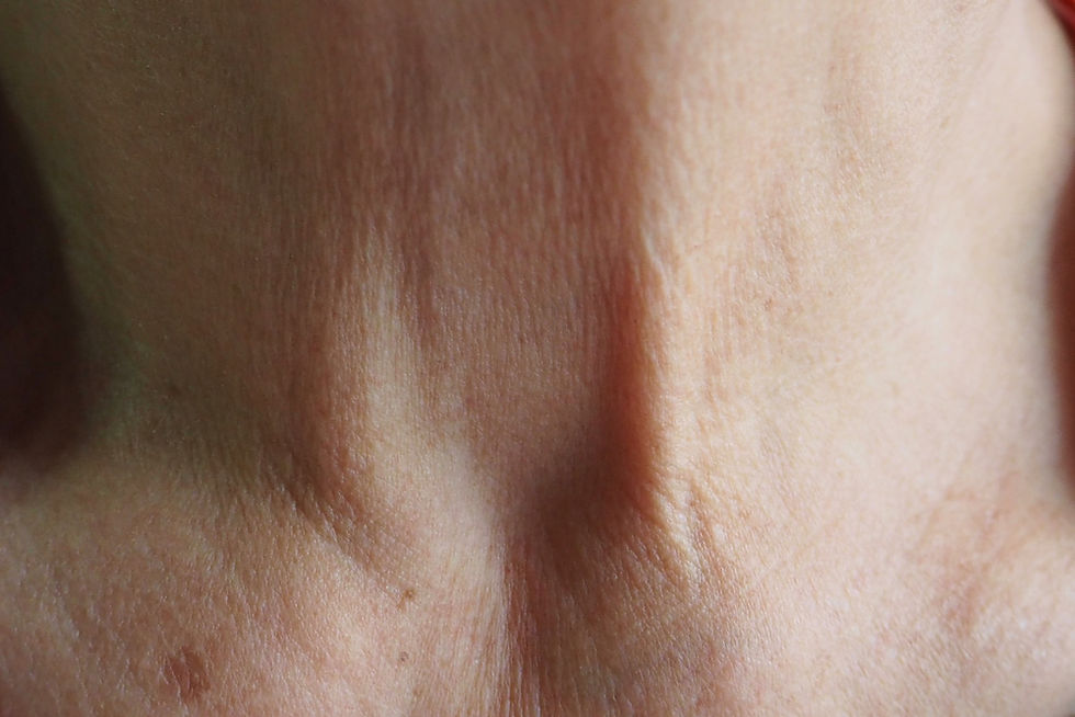how to tighten neck skin