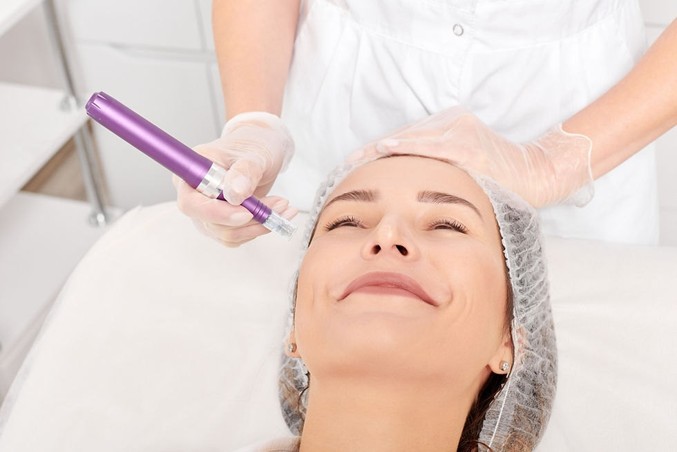 PRP Microneedling