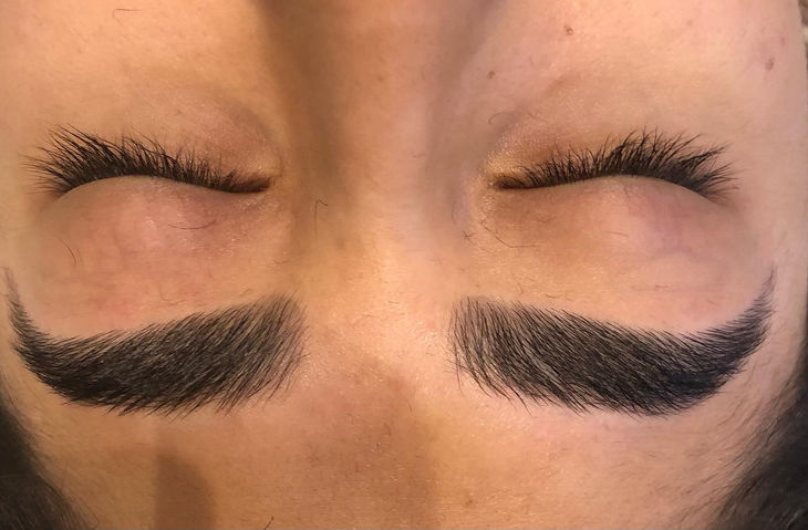 Brow treatment
