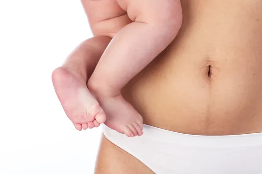 Woman's belly after six months of birth .webp