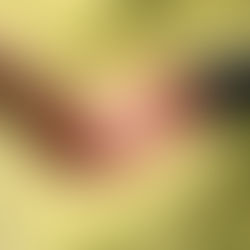 When Stories Overlap: What a Stroke Survivor Can Learn From Parkinson’s, Caregivers, and the Power of Support