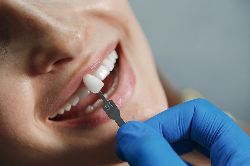 Tooth shade matching during a cosmetic dental exam.