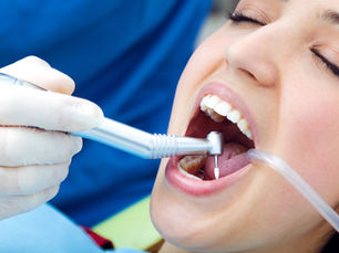 Dental Bonding vs Veneers: Which Is Right for You?